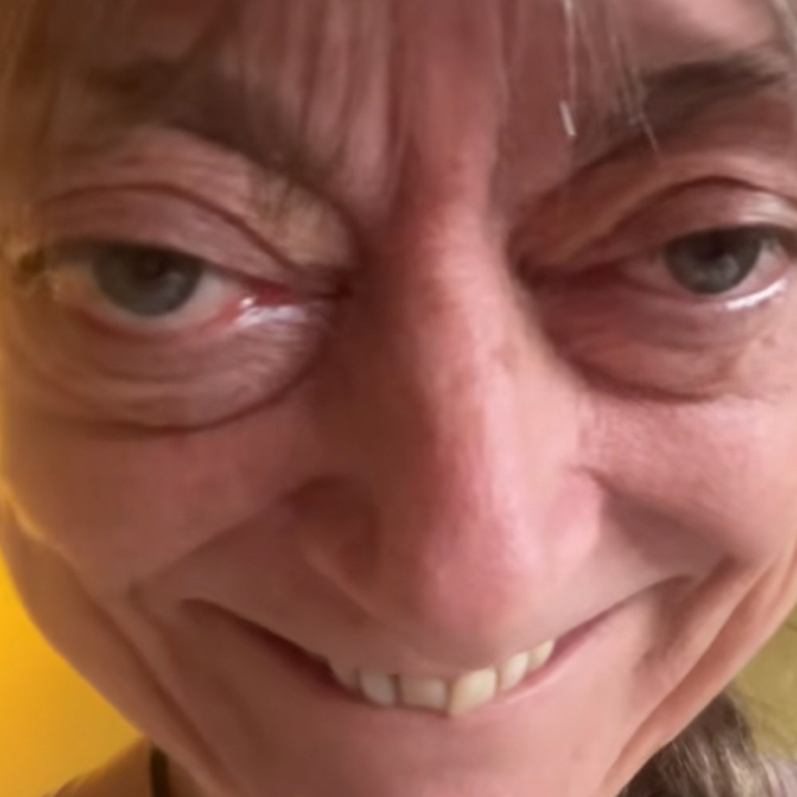 BBL 